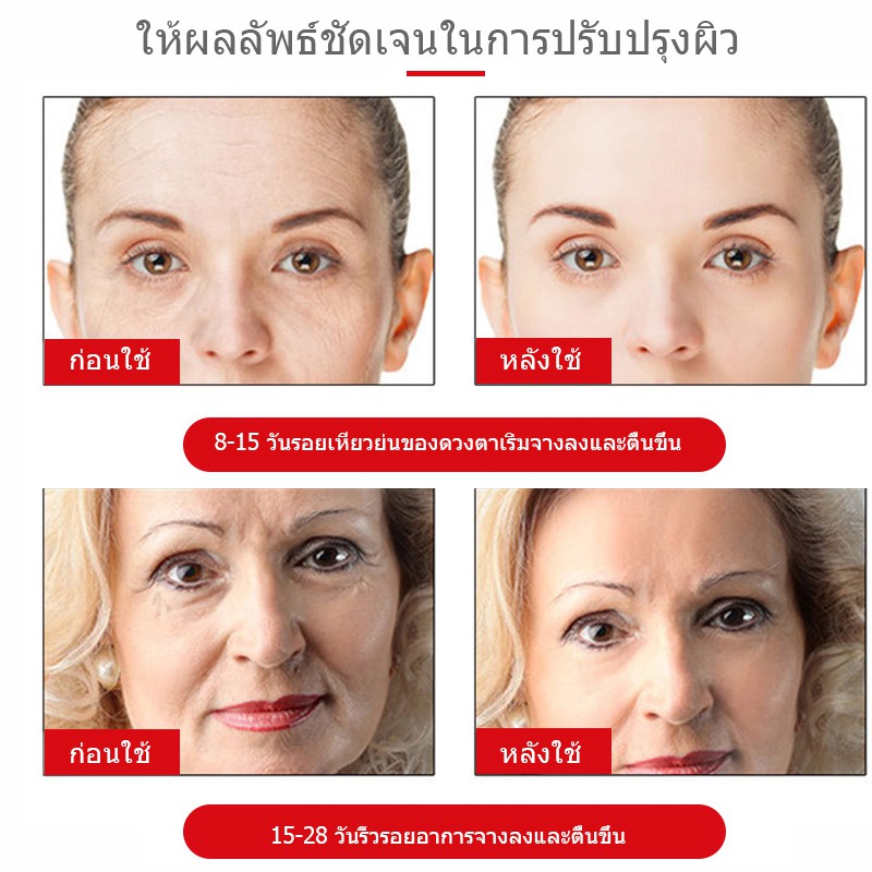 aliverครีมลดริ้วรอย-50ml-ต่อต้านวัย-ลดเลือนริ้วรอย-ครีมลบริ้วรอย-ครีมต่อต้านริ้วรอย-เอสเซ้นส์ต่อต้านริ้วรอย