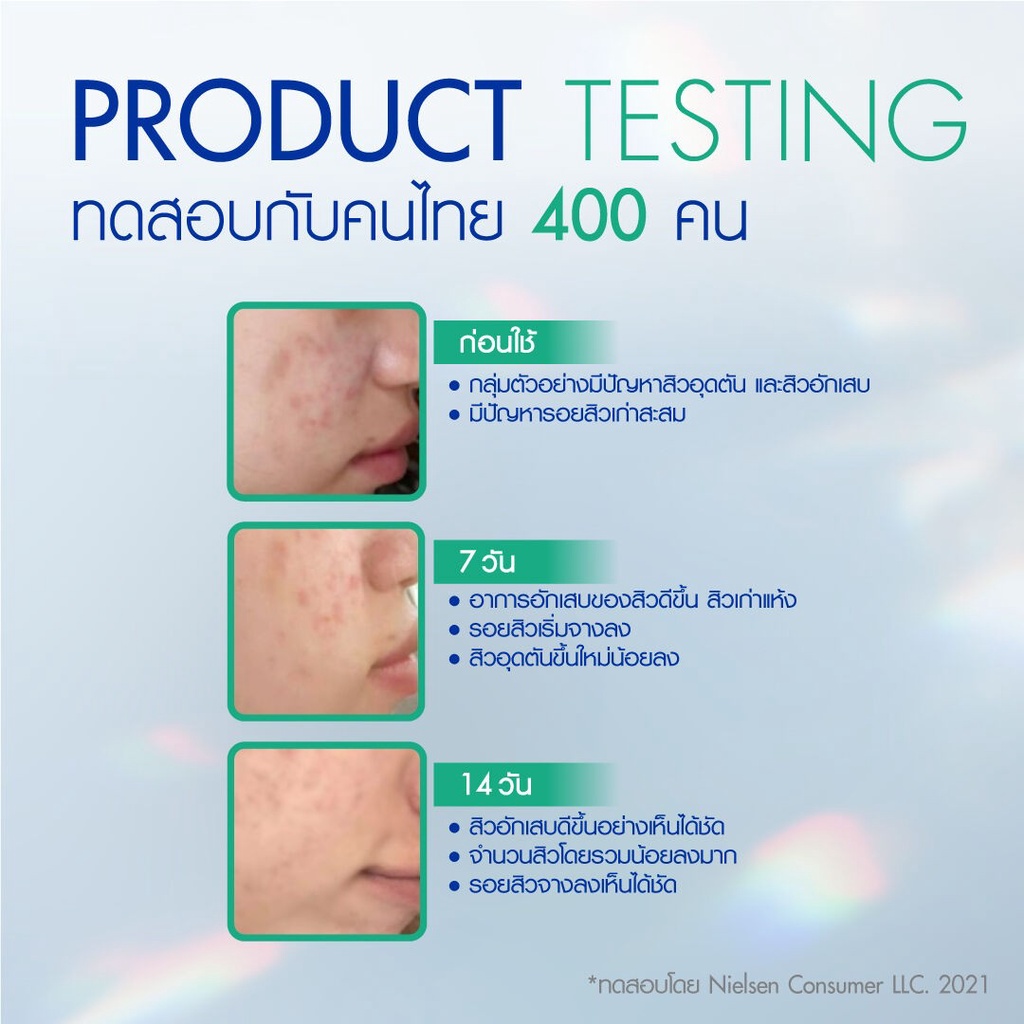 2-ขนาด-nivea-acne-repair-micellar-advance-นีเวีย-แอคเน่-รีแพร์-ไมเซล่า-แอดวานซ์-คลีนซิ่งลบเครื่องสำอางสูตรอ่อนโยน