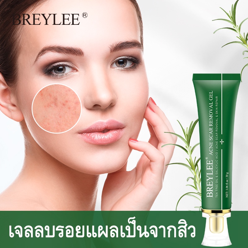 คูปองใหญ่-breylee-เจลแต้มสิว-ลบรอยสิว-เจล-fda-ยาลดสิว-ลดรอยสิว-ครีมลดสิว-ครีมลดรอยสิว-ครีมลบรอยสิว-remove-acne-scars