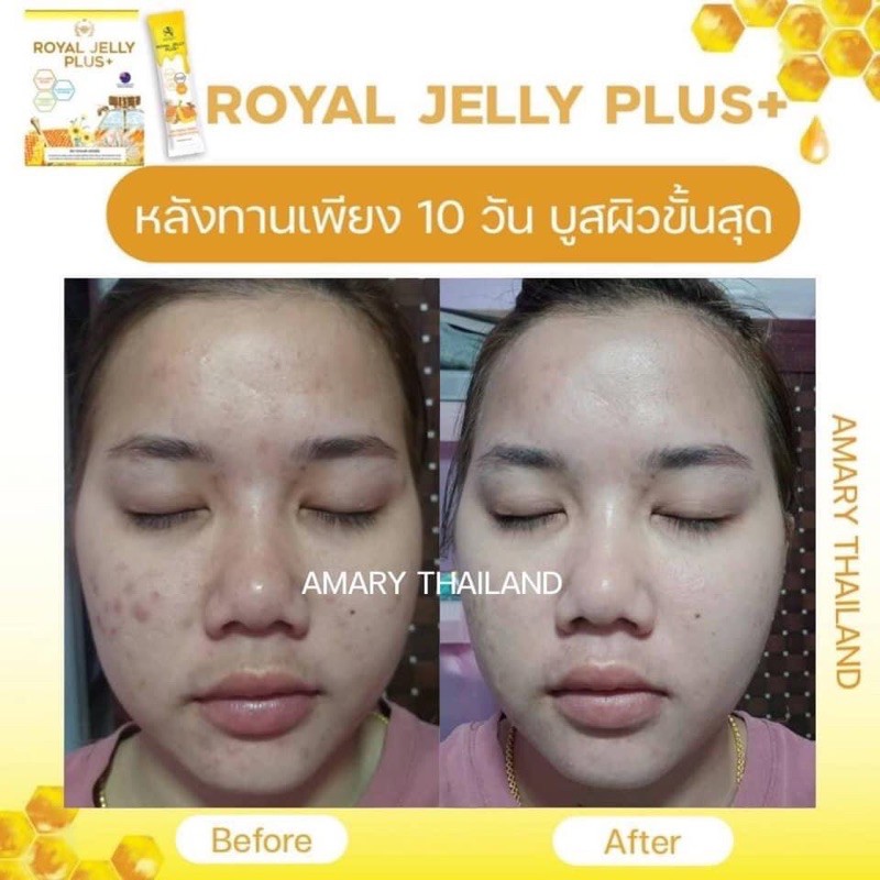 ภาพสินค้าส่งฟรี Amary Royal Jelly Plus+  นมผึ้งแบบชง อาหารผิว บำรุงผมเล็บ การนอนหลับ จากร้าน jbss.shop บน Shopee ภาพที่ 6