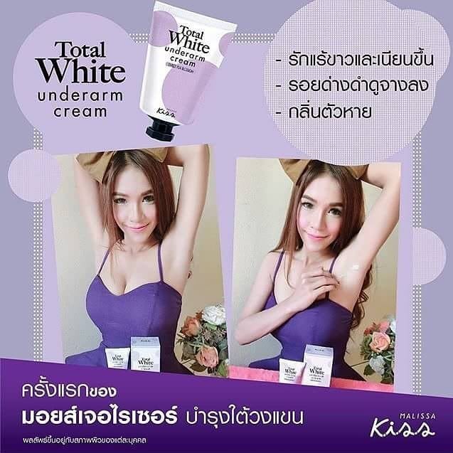 ครีมรักแร้ขาว-มาริสา-คิดส์-malissa-kiss-total-white-underarm-cream-30ml-sweet-pea-blossom-มาริสา-ลดปัญหาหนังไก่