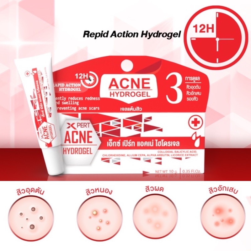 ล็อตใหม่สุด-22-11-24-mckrime-acne-hydrogel-10-g-รักษาสิว-สิวอักเสบ-สิวผด-สิวหัวหนอง-gt-หลอดแดง-lt