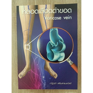 9786164434028 หลอดเลือดดำขอด (VARICOSE VEIN)