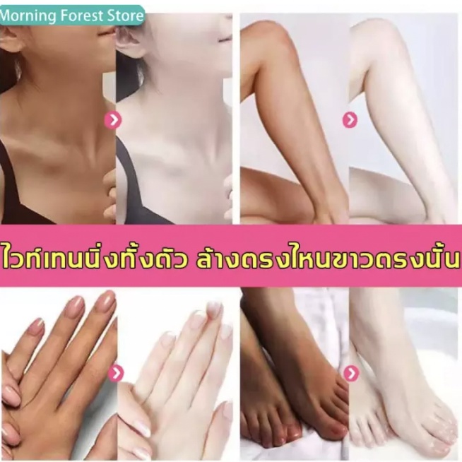 aichun-สบู่ผิวขาว-สบู่ผิวขาวไว-100-สบู่ผิวขาว-ปรับปรุงความหมองคล้ำ-สบู่สูตรลับเฉพาะ-สบู่ก้อน-สบู่หน้าขาวใส