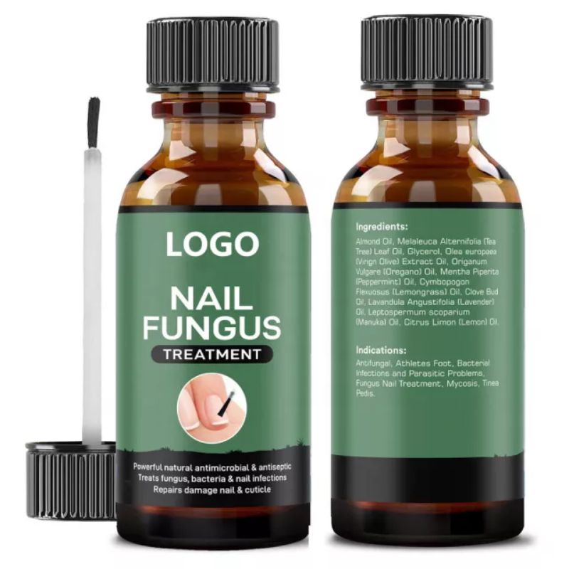 nail-fungus-วิธีแก้ปัญหาการรักษาเชื้อราเล็บ-มือและเล็บเท้าที่แข็งแรงติดเชื้อรา10ml