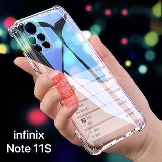 🔥🔥 เคสใส Case  infinix Note 11S เคสโทรศัพท์ อินฟินิ๊ก เคสใส เคสกันกระแทก case Infinix note11S พร้อมส่งทันที