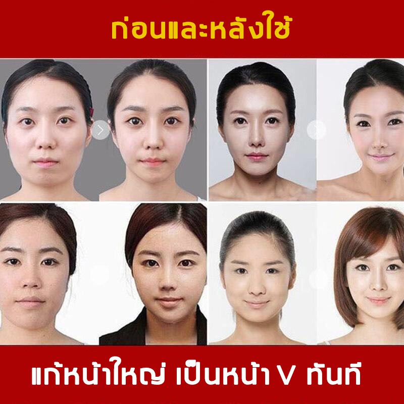 เซรั่มหน้าเรียว-ครีมหน้าเรียวv-ครีมหน้าเรียว-ปรับหน้าให้เรียวสวย-รูป-v-ลดโทนเหลืองของผิวลง-ปรับสีผิวให้กระจ่างใส-คอลลาเจนบำรุงผิว