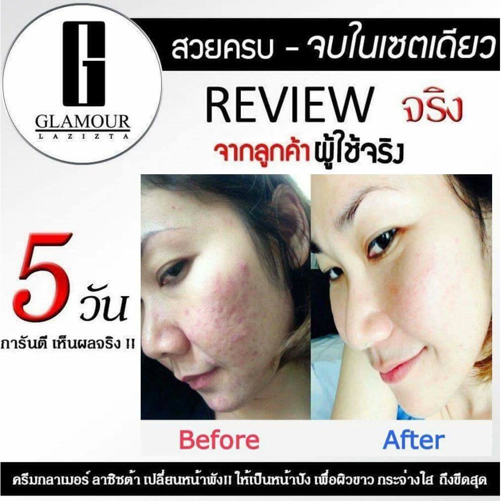 เซรั่มลดริ้วรอย-หน้าดูกระชับ-แลดูอ่อนเยาว์-glamour-lazizta-booster-white-essence