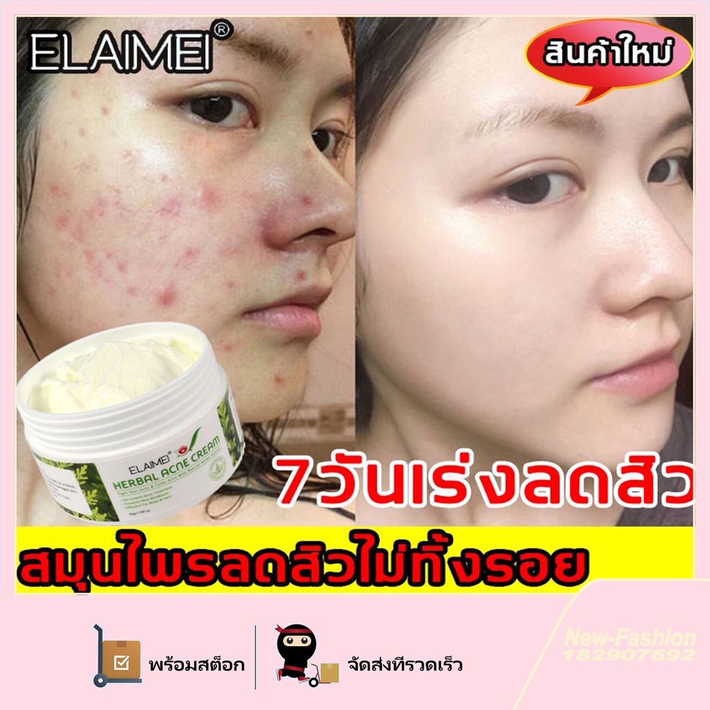 ครีมแต้มสิว-elaimei-ครีมลดสิว-ครีมรักษาสิว-ทำความสะอาดองล้ำลึก-สิวหายถาวร-เจลแต้มสิว-50g-เจลแต้มสิว-ครีมรักษาสิว-เซรั่มแต้มสิว-เจลรักษาสิว-ครีมกำจัดสิว