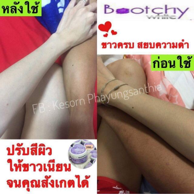 set-ครีมและสบู่-แก้รักแร้ดำ-ตูดดำ-คอดำ-ผิวดำ