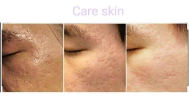 ครีมบำรุงผิวหน้า-ขาวใส-arbutin-care-skin-natural