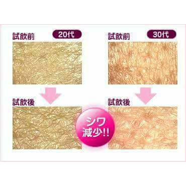 คอลลาเจน-บำรุงผิว-ส่งไวทันใจ-dhc-collagen-20-60วัน-ช่วยบำรุงผิวพรรณให้ดูกระชับเต่งตึง