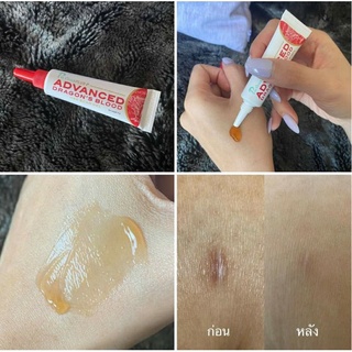 เจลลดรอย สูตรใหม่เข้มข้นขึ้น Puricas Plus Advanced Dragons Blood C&amp;E Scar Gel ใช้ได้กับทุกรอยแผลเป็นรอยแดง-ดำหรือรอยสิว