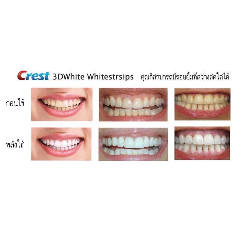 exp-12-24-crest-3dwhite-whitestrips-professional-effects-แผ่นฟอกฟัน