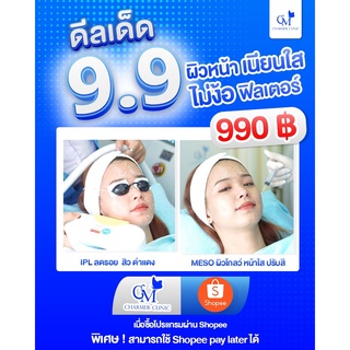 [E-VOCHER] Charmer clinic เมโสหน้าใสลดรอยสิว ด้วย IPL 1 ครั้งและ Meso หน้าใส 1 ครั้ง