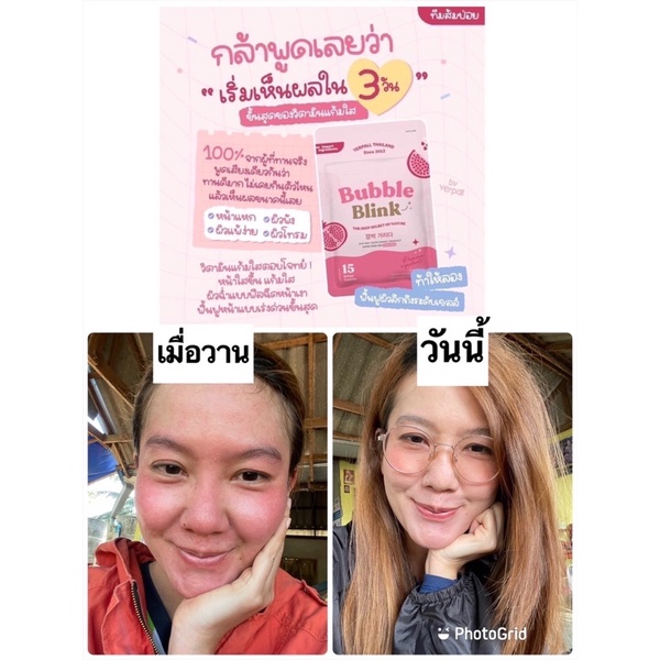 ภาพสินค้าวิตามินแก้มใส อาหารผิวฟื้นฟูระดับเซลผิว % จากร้าน s.sirikan.shop บน Shopee ภาพที่ 5