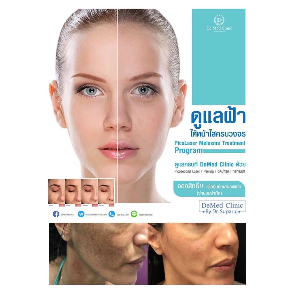 demed-melasma-care-set-ชุดผลิตภัณฑ์ดูแลปัญหาฝ้า-by-demed-clinic