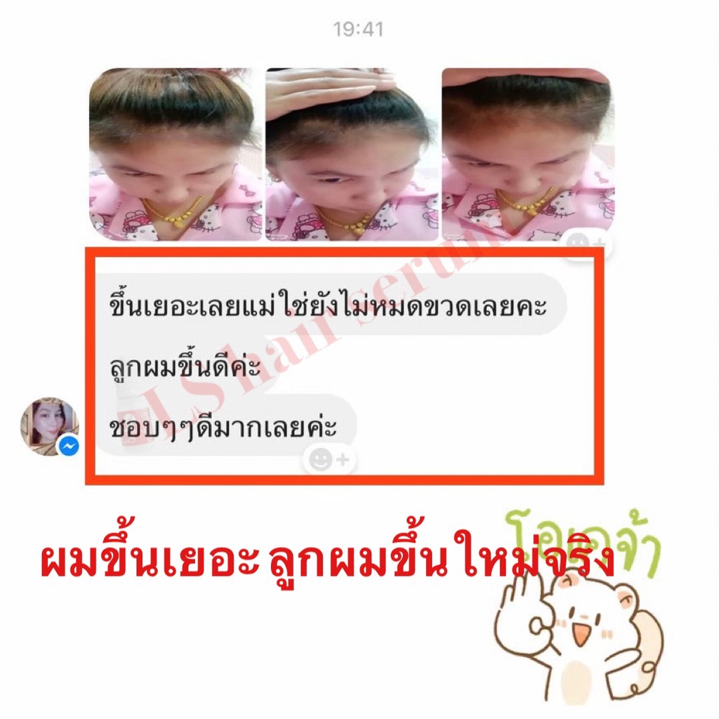 หัวเชื้อผมยาว-หัวเชื้อแก้ผมร่วง-ปลูกผม-ปลูกหนวด-ผสมแชมพู-1-ต่อ-1