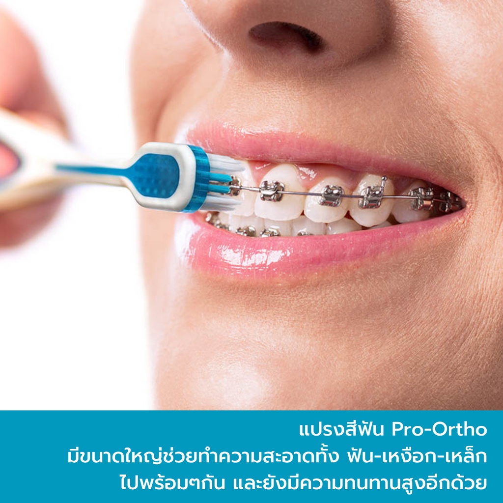 สำหรับคนจัดฟัน-edel-white-pro-ortho-แปรงสีฟันสำหรับคนจัดฟัน