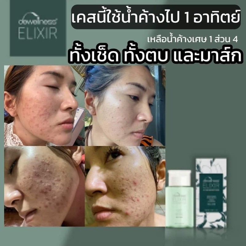 น้ำค้างธรรมชาติ-6-in-1-ทำความสะอาดผิวหน้าและบำรุงอย่างล้ำลึก