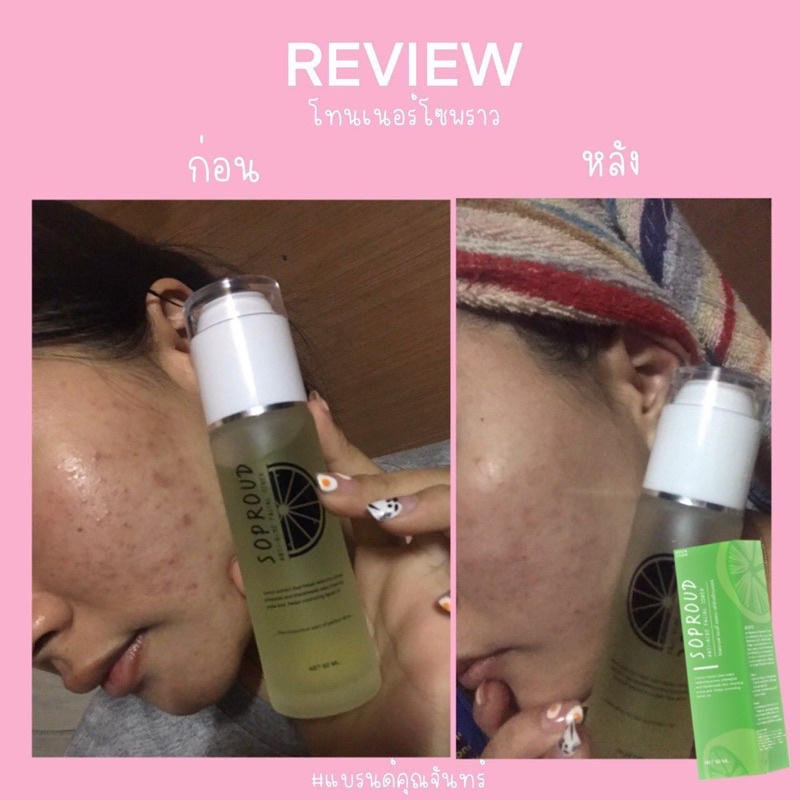 โทนเนอร์ลดสิว-ขนาด-60-ml-deproud-ส่งฟรี-มีของแถม