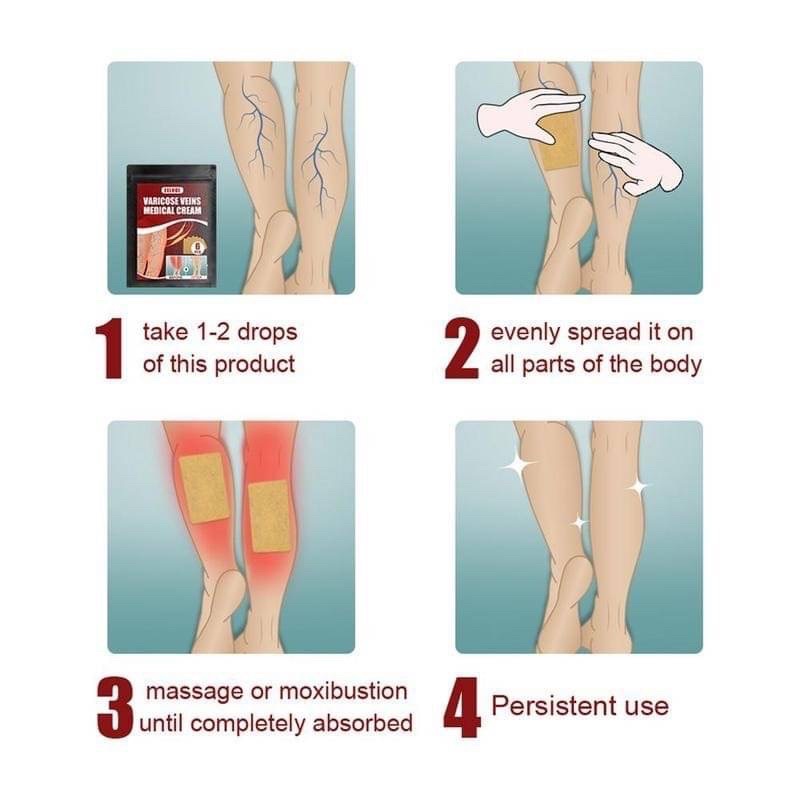 eelhoe-varicose-veins-แผ่นแปะสมุนไพรแก้เส้นเลือดขอด