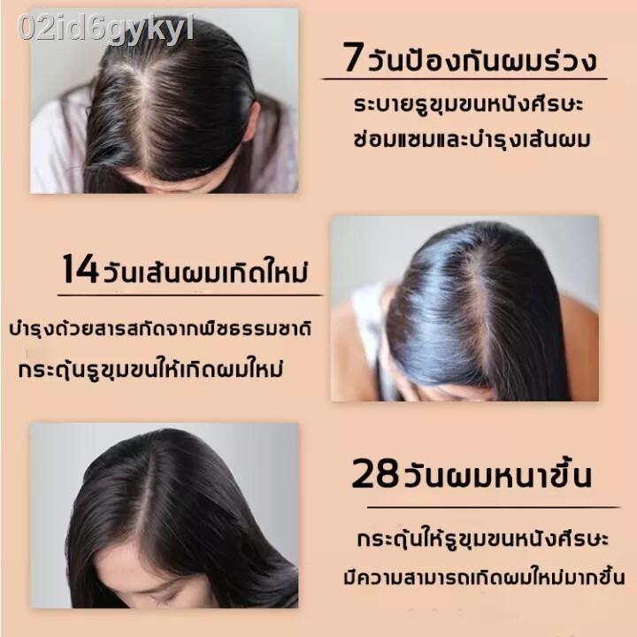 สินค้าขายดีเป็นพิเศษ-2-ขวด-zenshow-แชมพูแก้ผมร่วง-แชมพูขิงเพียว-เซรั่มขิงบำรุงผม-ยาสระผมขิง-แชมพูขิง-เซรั่มแก้ผมร่วง