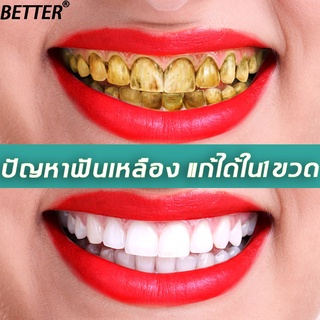 BETTER  มูสแปรงฟันขาว 60ml แก้ฟันเหลือง ยาสีฟันฟันขาว ขจัดคราบหินปูนและกลิ่นปาก น้ำยาฟอกสีฟัน คราบจุลินทรีย์ฟั