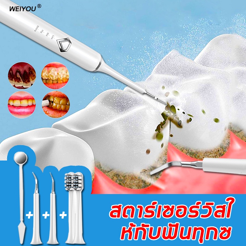 ซื้อมันดีกว่าไปล้างฟันที่รพประหยัดเงินกว่าsmile-athome-ทำความสะอาดฟัน-ความสะอาดฟันไฟฟ้า-เครื่องขัดหินปูน-เครื่องขัดฟัน