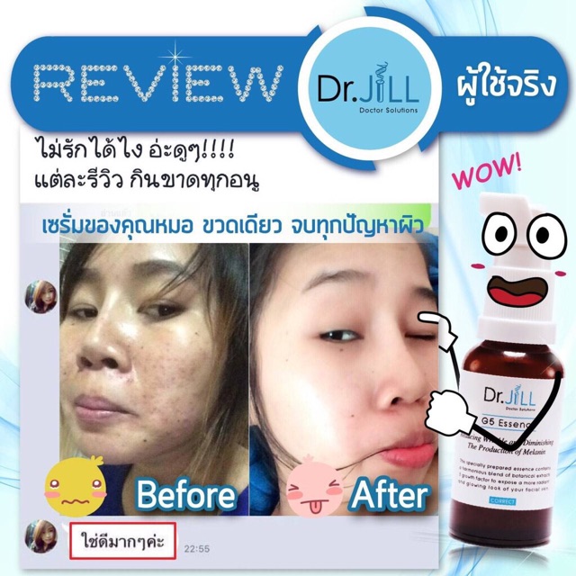 drjillg5essence-เซรั่มน้ำนมเข้มข้น