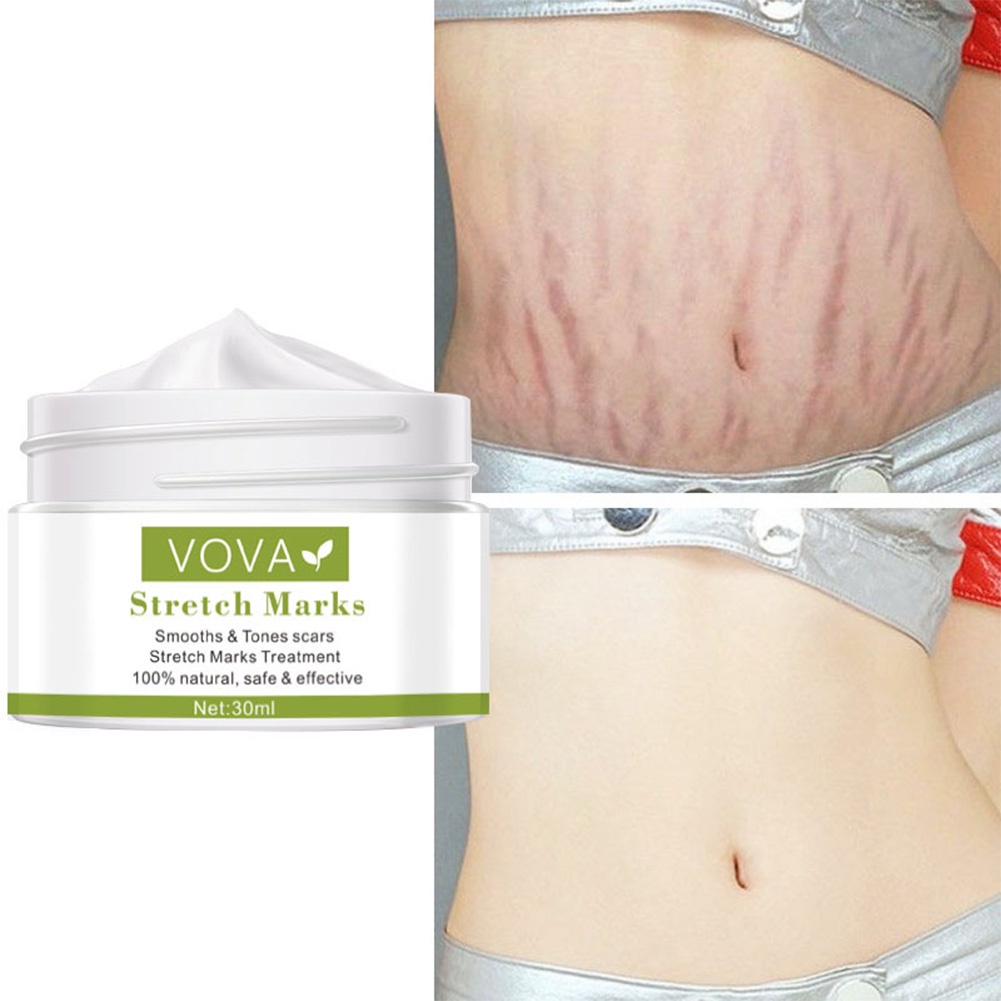 Amazon rosarden stretch mark prevention cream for pregnancy