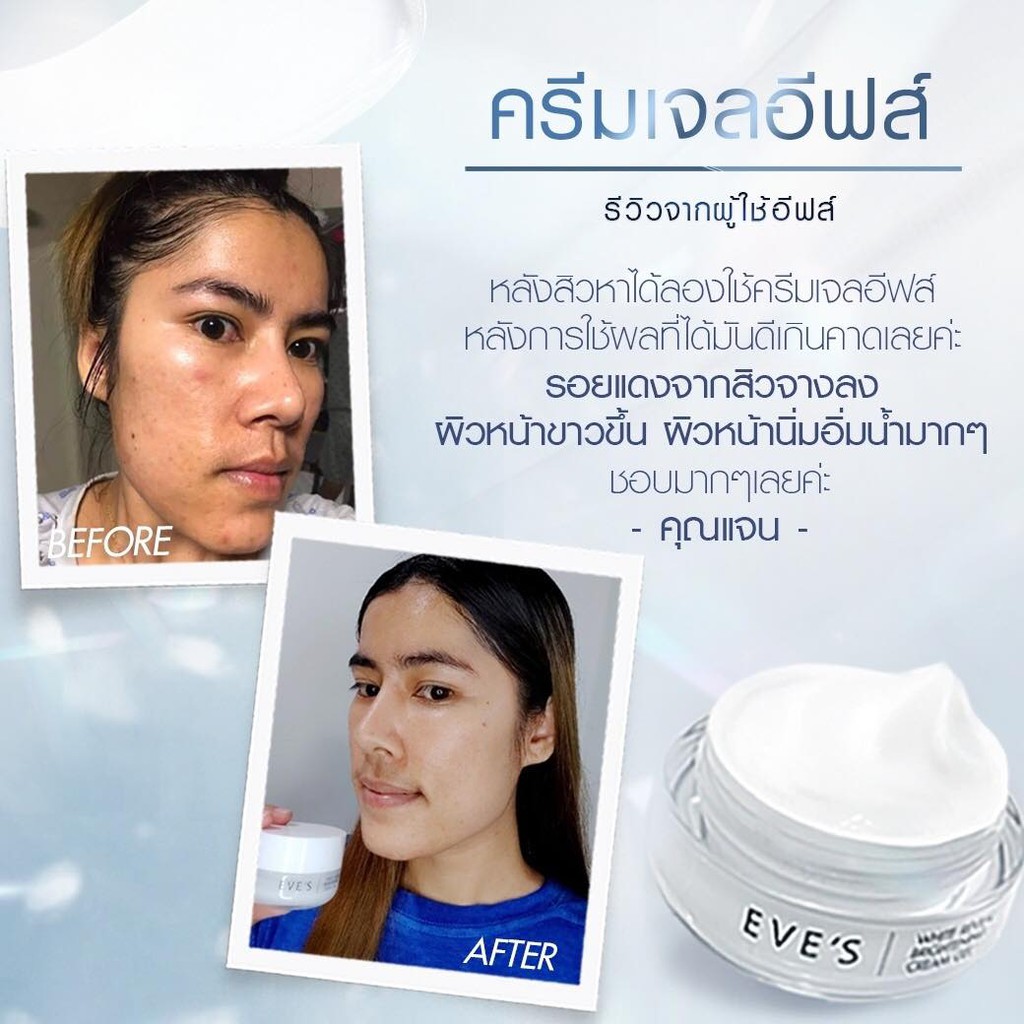 ครีมเจลอีฟส์-20g-ผลิตภัณฑ์บำรุงผิวหน้า-ลดรอยสิว-ลดเลือน-ฝ้า-กระ-จุดด่างดำ-ผิวกระจ่างใส