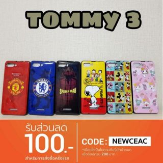 เคส tommy 3 / tommy3