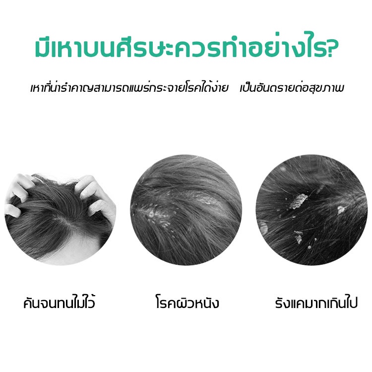 ศีรษะไม่คันต่อไปอีก-yongjun-หวีกำจัดเหา-หวีเหาอย่างรวดเร็วและไม่เจ็บปวด-หวีเหา-ที่รีดเหา-หวีสางเหาไฟฟ้า