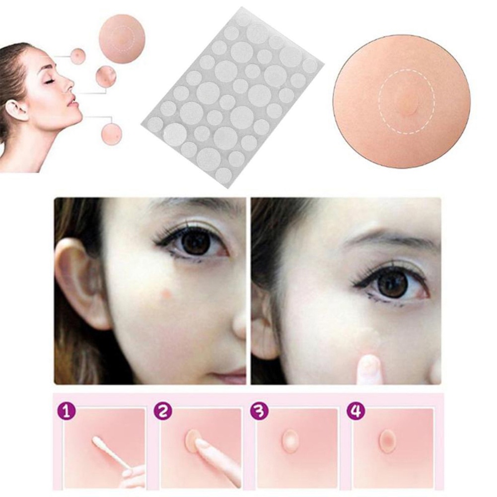 acne-patch-amp-skin-tags-ชุดความงาม-remover-pimple-master-patch-สิวที่มองไม่เห็น-pimple-removal-patch-bri