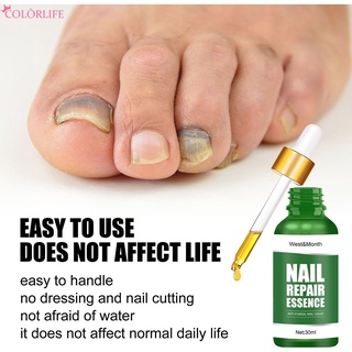 【ใหม่】น้ำยาทําความสะอาดเล็บมือ และเล็บเท้า ป้องกันเชื้อแบคทีเรีย และเชื้อราที่เล็บ