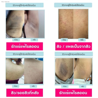 🔥ส่งไวจากไทย🔥NAKIZ LIVELY BUTT - ครีมทา ก้นดำ รักแร้ดำ ขาหนีบดำ สิวหลัง หัวเข่าดำ ศอกดำ ลบเลือนรอยดำ แตกลาย คอดำ 10