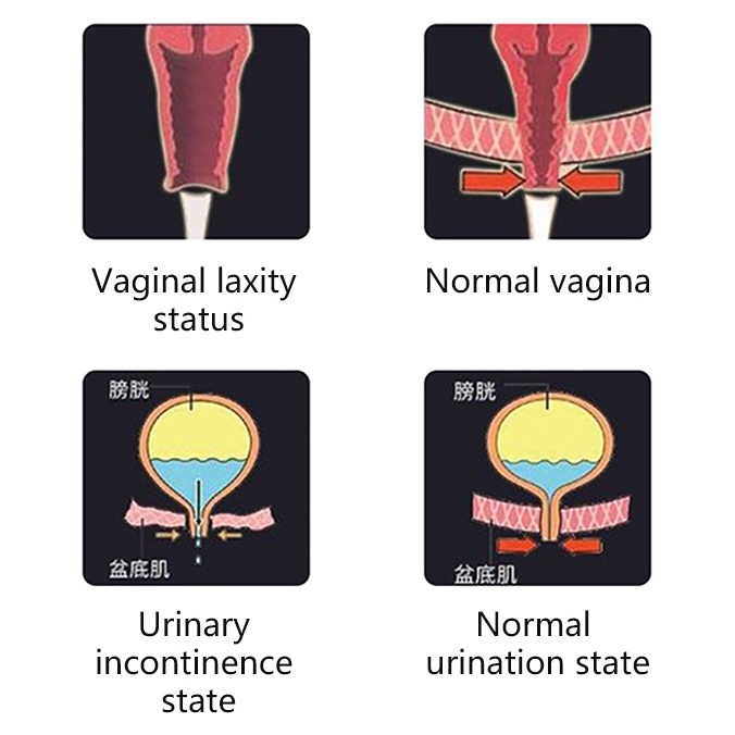 pelvic-floor-machine-pelvic-floor-muscle-repair-incontinence-chair-glute-muscle-exerciser-pelvic-floor-muscles-chair-hou