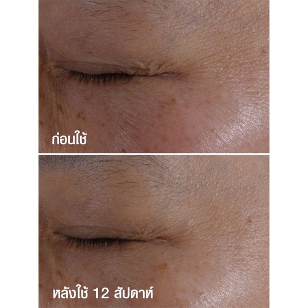 clinique-smart-clinical-repair-wrinkle-correcting-eye-cream-ขนาด-15-มล