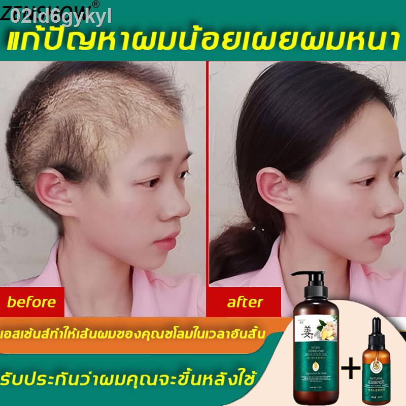 สินค้าขายดีเป็นพิเศษ-2-ขวด-zenshow-แชมพูแก้ผมร่วง-แชมพูขิงเพียว-เซรั่มขิงบำรุงผม-ยาสระผมขิง-แชมพูขิง-เซรั่มแก้ผมร่วง