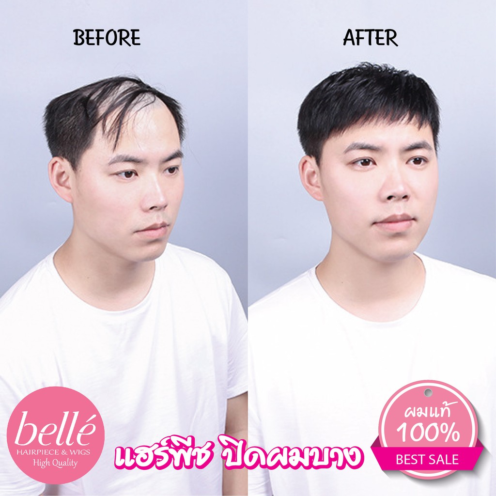 belle-แฮร์พีช-ผมแท้-100-ทำสีได้-วิกผม-ปิดผมบาง-ปิดหัวล้าน-ผู้ชาย-สีดำธรรมชาติ-พร้อมส่ง