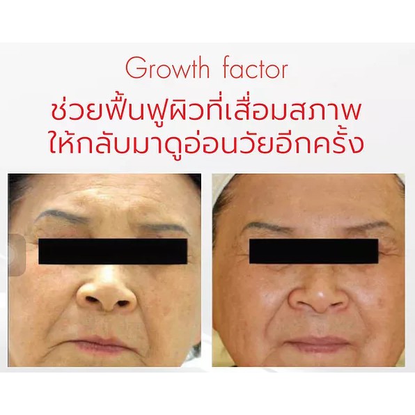 growth-factor-total-age-lift-essence-10-g-เอสเซนต์-สูตรเข้มข้น-ฟื้นฟูสภาพผิวหน้า-เติมเต็มร่องลึก-ลด-ริ้วรอย-บนใบหน้า