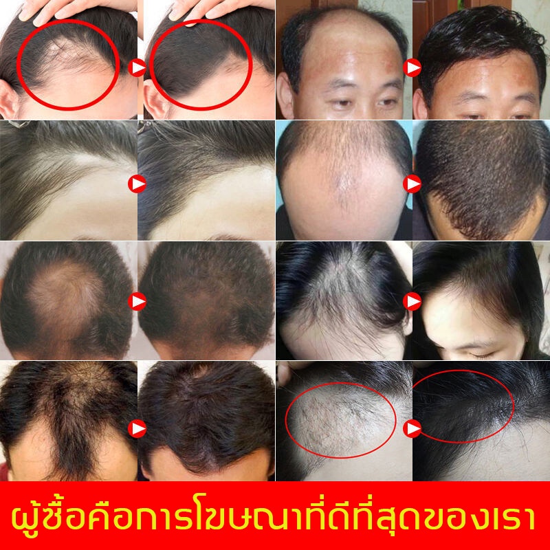 peimei-แชมพูสมุนไพรขิงบำรุงผม-250ml-แชมพูปลูกผม-แชมพูปลูกผมดก-ยาสระผมเร่งผมยาว-แชมพูขิง-แชมพูสมุนไพร-แชมพูบำรุงผม