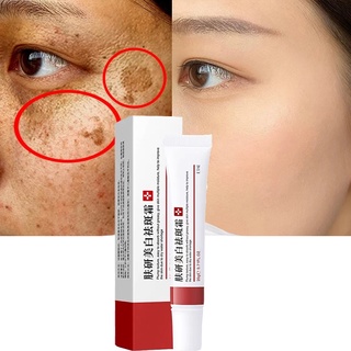 ✿Ready stock✿Whitening Freckle Cream Remove Melasma Cream Remove Dark Spots Melanin Melasma Remover Brighten Skin Anti-Aging Skin-Lightening