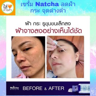 [ส่งฟรี] เซรั่ม แก้ฝ้า สลายฝ้า รักษาสิว ลดริ้วรอย ❌ระวังของปลอมราคาถูก❌ ซื้อที่นี่ของแท้ ล้าน%