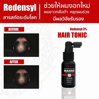 Masso Hair Tonic มัสโซ่ แฮร์ โทนิค ผลิตภัณฑ์ ปลูกผมจากสารสกัด Redensyl  ช่วยผมงอกใหม่ ลดการขาดหลุดร่วง ผมขาวกลับมาดำ