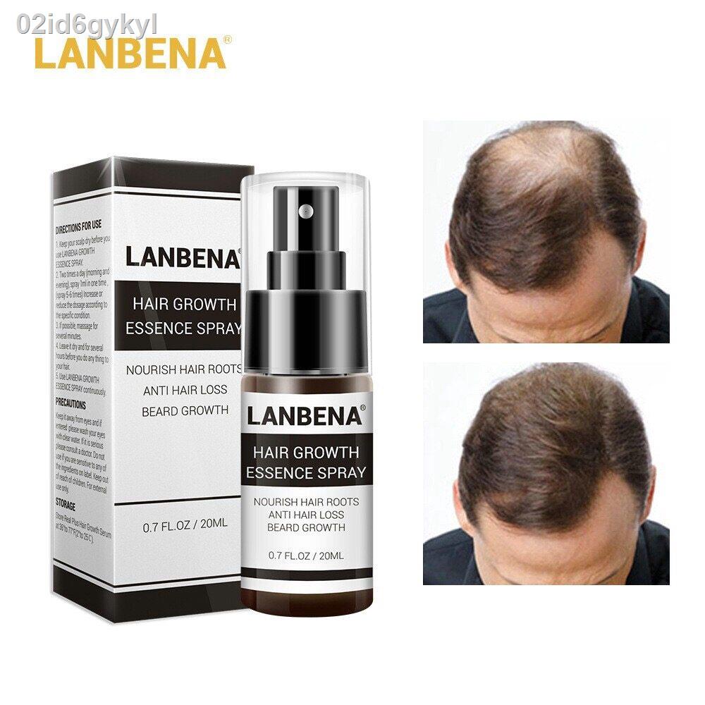 จัดโปร-สเปรย์เซรั่มปลูกผม-lanbena-hair-growth-essence-แก้ปัญหาผมบาง-ผมร่วง-ศรีษะบาง-ผมหลุดร่วงง่าย-ดูแลรักษาเส้นผมอย่