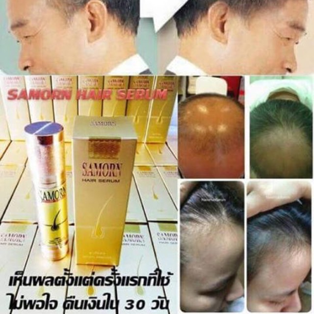 เซรั่มปลูกผมแซมออน-samorn-hair-serum-มีเก็บปลายทาง