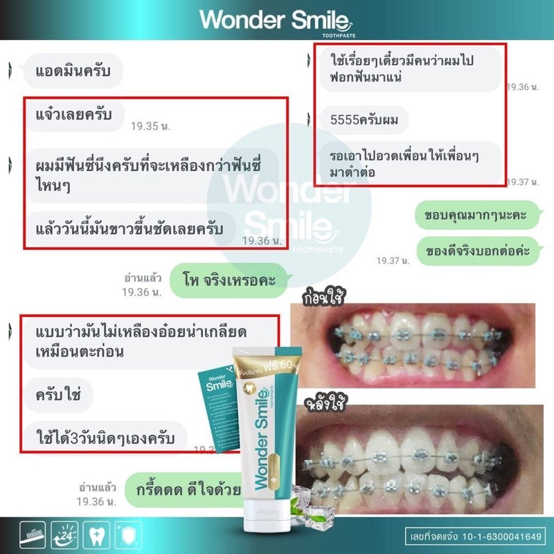 1-ฟรี-1-wonder-smile-ยาสีฟันวันเดอร์สไมล์-ฟันขาวแบบไม่ต้องฟอก-ลดกลิ่นปาก