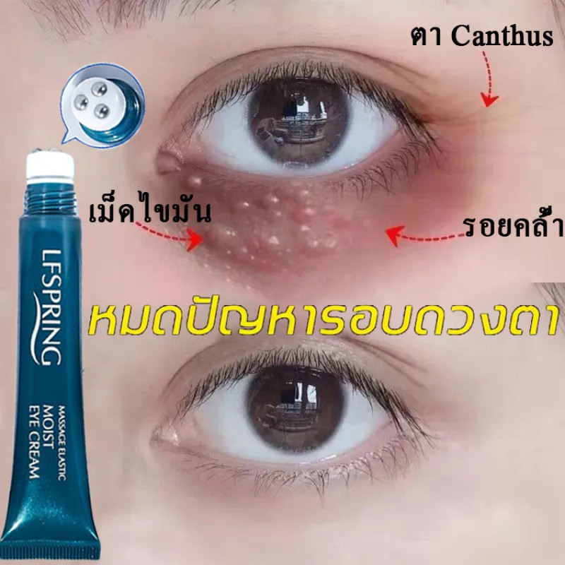 ครีมบำรุงรอบตา-ครีบทารอบดวงตา-อายครีมบำรุงตา-ครีมลดถุงใต้ตา-ลบเลือนรอยคล้ำ-ยกกระชับ-ต่อต้านริ้วรอย-รอยย่น-เลือนริ้วรอย-เม็ดไขมัน